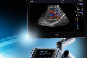 ultrasound ultrasound